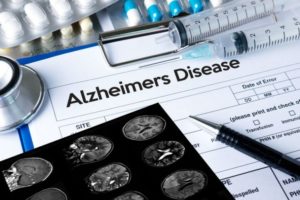 Ser bilingüe previene el Alzhéimer